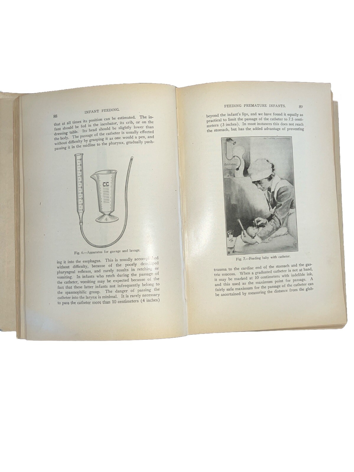 Principles And Practice Of Infant Feeding 1922 Julius H. Hess M.D. Hardback