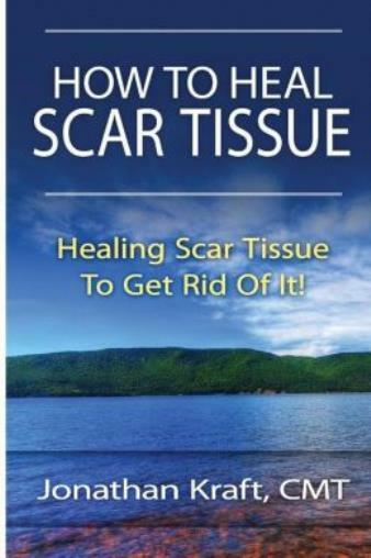 How To Heal Scar Tissue: How To Heal Your Own Scar Tissue And Get Rid Of It…