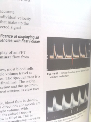 Understanding Ultrasound Physics (Rev Ed) by Edelman, Sidney K.