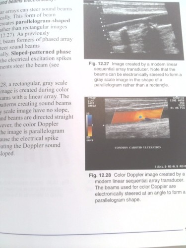Understanding Ultrasound Physics (Rev Ed) by Edelman, Sidney K.